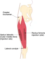 Im-vastus-lateralis.webp