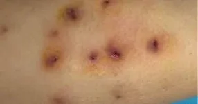 1000017665.webp 1000017665.webp